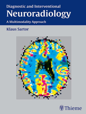 cover image of Diagnostic and Interventional Neuroradiology